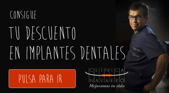descuento-implantes-dentales-clinica-dental-madrid