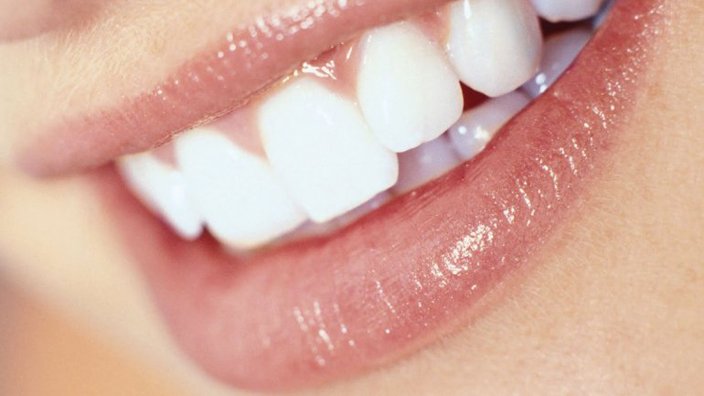 objetivos de la estetica dental, una sonrisa perfecta