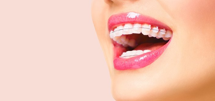 algunos problemas por no usar ortodoncia en jovenes