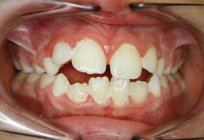 alteraciones esqueleticas en ortodoncia