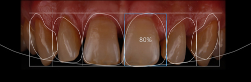 esquema con la posición de los dientes en DSD
