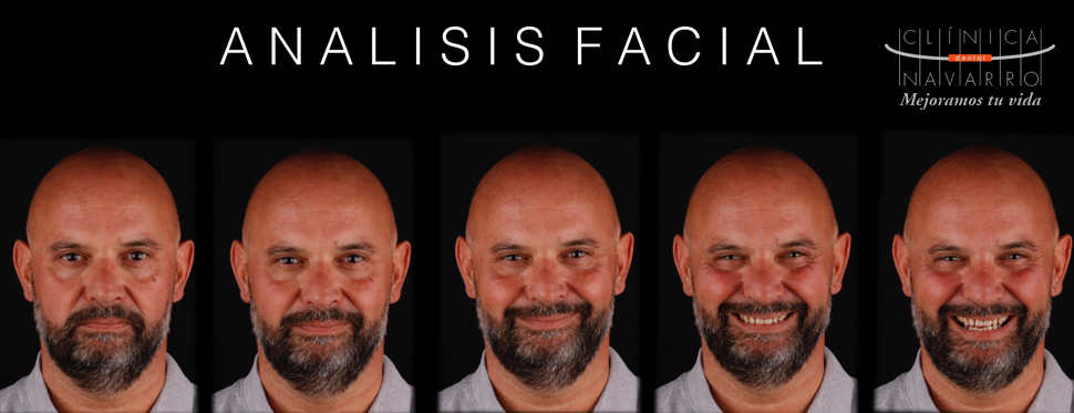 analisis de la cara para diseño de sonrisa digital