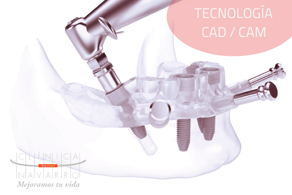 alquitrán Excluir diluido Diseño y elaboración de prótesis dentales mediante CAD CAM