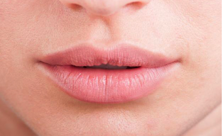 consejos y tips contra la queilitis y los labios secos en invierno y con frío
