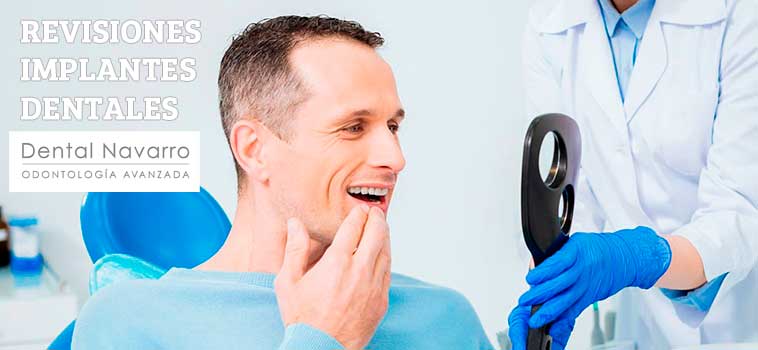 revisiones periódicas implantes dentales