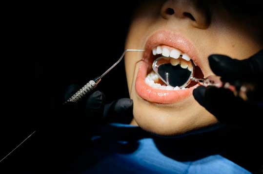 importancia dientes primarios, tratamiento y caída prematura
