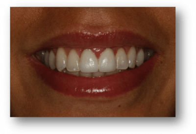 clinica dental navarro implantes madrid
