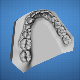 ortodoncia-ordenador-madrid