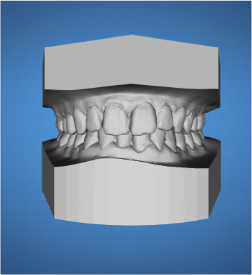 ortodoncia-ordenador-madrid2