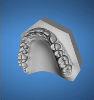 ortodoncia-ordenador-madrid3