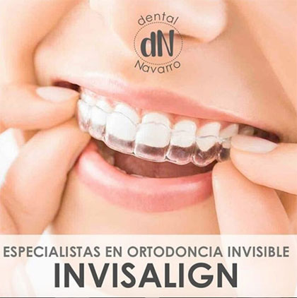 Dentistas especialistas en ortodoncia invisible invisalign en Madrid